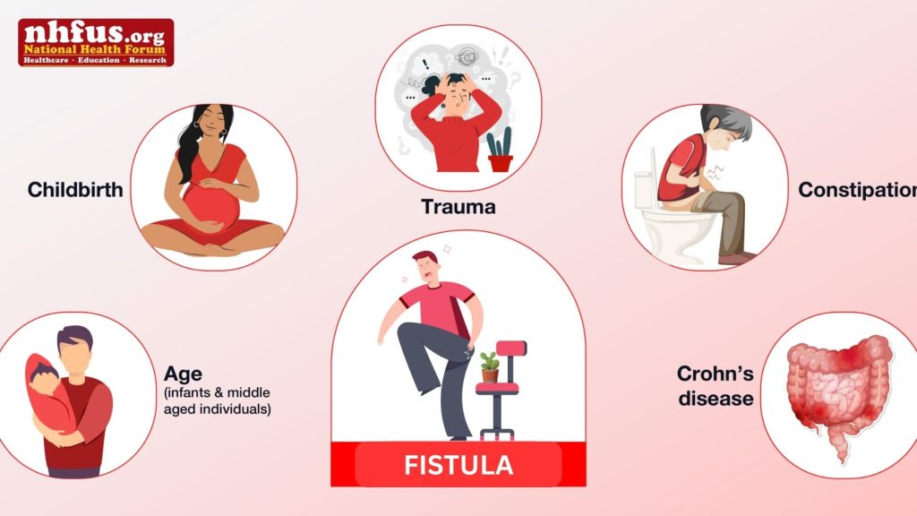 Help Women with Fistula