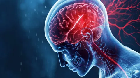 Recognizing the Warning Signs of a Stroke