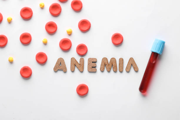 Anemia Symptoms and Common Causes