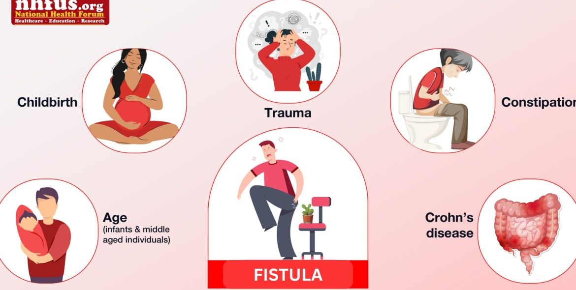 Help Women with Fistula
