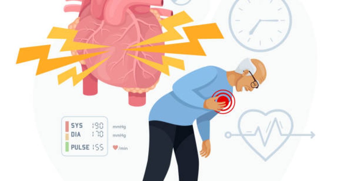 Heart Attack Symptoms