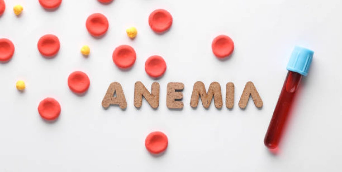 Anemia Symptoms and Common Causes